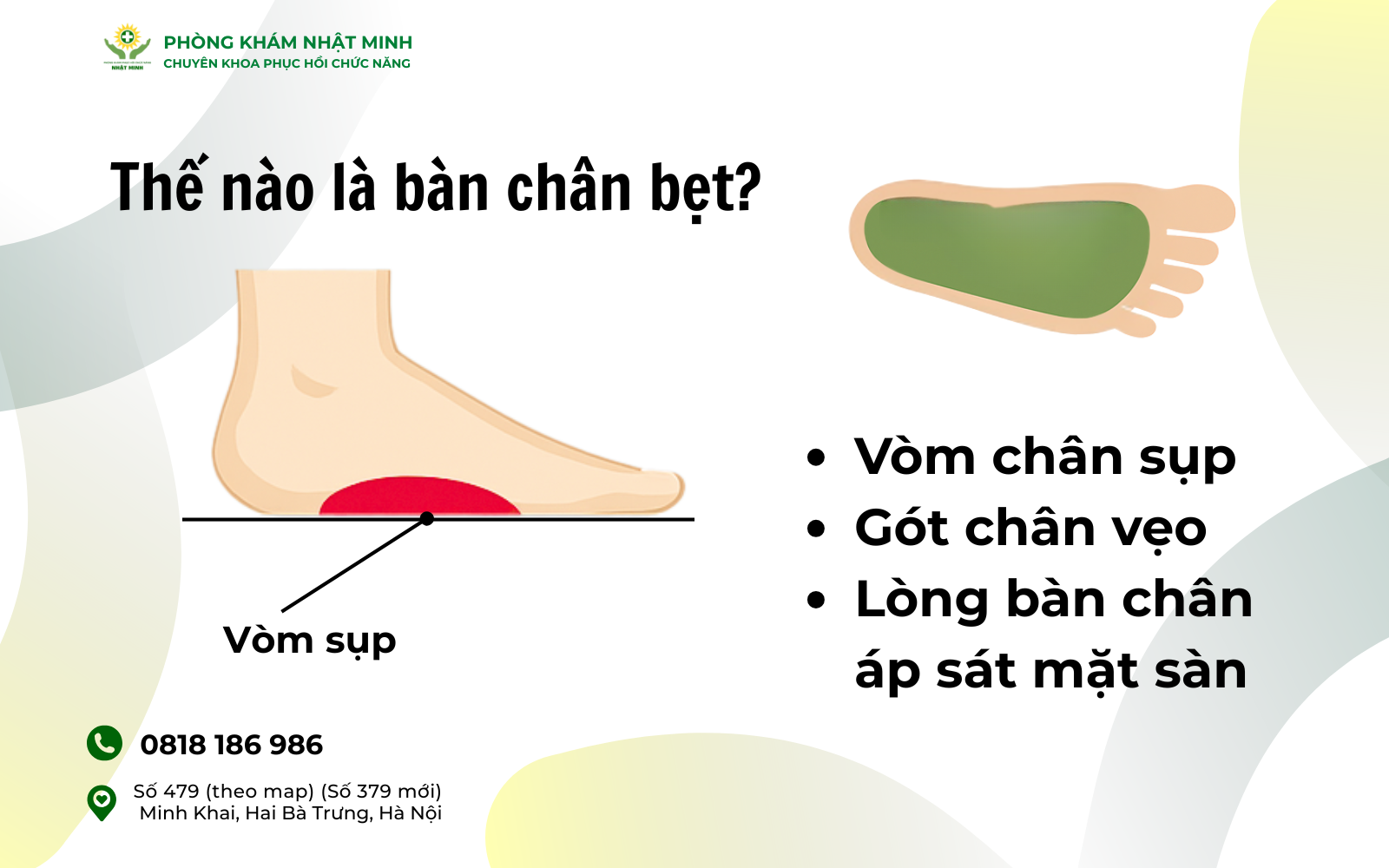 Thế nào là bàn chân bẹt.png